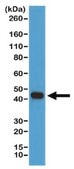 Anti-beta-Actin Antibody, clone RM112 clone RM112, from rabbit