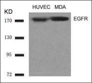 Anti-EGFR (Ab-1070) antibody produced in rabbit affinity isolated antibody