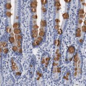 Anti-GNAS antibody produced in rabbit Prestige Antibodies® Powered by Atlas Antibodies, affinity isolated antibody, buffered aqueous glycerol solution