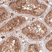 Anti-TAX1BP1 antibody produced in rabbit Prestige Antibodies® Powered by Atlas Antibodies, affinity isolated antibody, buffered aqueous glycerol solution