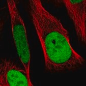 Anti-RCC1 antibody produced in rabbit Prestige Antibodies® Powered by Atlas Antibodies, affinity isolated antibody, buffered aqueous glycerol solution, ab1