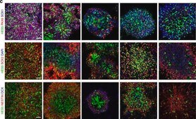 Anti-Doublecortin Antibody serum, from guinea pig