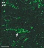 Anti-Chondroitin Sulfate Proteoglycan Antibody, Brain (core protein), clone Cat-301 clone Cat-301, Chemicon®, from mouse