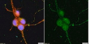 Anti-Vesicular Glutamate Transporter 1 Antibody serum, Chemicon®