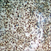 Anti-phospho-PP2A-α (pTyr307) antibody produced in rabbit affinity isolated antibody