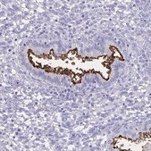 Anti-SLC34A2 antibody produced in rabbit Prestige Antibodies® Powered by Atlas Antibodies, affinity isolated antibody, buffered aqueous glycerol solution