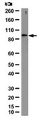 Anti-NLRP6 (NALP6) Antibody from rabbit, purified by affinity chromatography