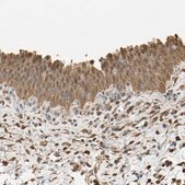 Anti-S100A6 antibody produced in rabbit Prestige Antibodies® Powered by Atlas Antibodies, affinity isolated antibody, buffered aqueous glycerol solution