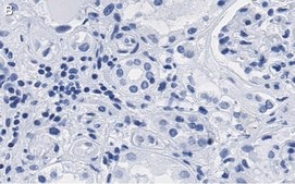 Anti-PARP-1 Antibody, clone 12N17 Antibody, ZooMAb® Rabbit Monoclonal recombinant, expressed in HEK 293 cells