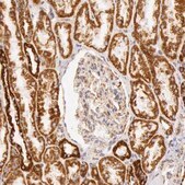 Anti-ATP5B antibody produced in rabbit Ab1, Prestige Antibodies® Powered by Atlas Antibodies, affinity isolated antibody, buffered aqueous glycerol solution