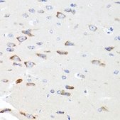 Anti-PIK3CA antibody produced in rabbit