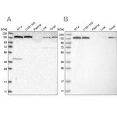 Anti-PFAS antibody produced in rabbit Prestige Antibodies® Powered by Atlas Antibodies, affinity isolated antibody, buffered aqueous glycerol solution, Ab2