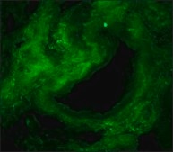 モノクロナール抗コラーゲン, I型 マウス宿主抗体 clone COL-1, ascites fluid