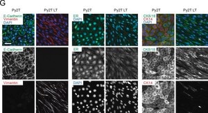 Monoclonal Anti-Vimentin antibody produced in mouse clone LN-6, ascites fluid