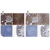 Anti-ASS1 antibody produced in rabbit Prestige Antibodies® Powered by Atlas Antibodies, affinity isolated antibody, buffered aqueous glycerol solution, Ab1