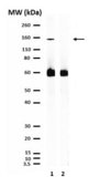 Anticuerpo anti-colágeno tipo I from rabbit, purified by affinity chromatography