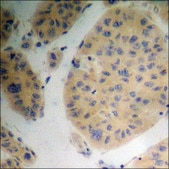Anti-phospho-PP2A-α (pTyr307) antibody produced in rabbit affinity isolated antibody