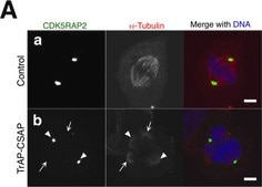 Anti-CDK5RAP2 Antibody from rabbit, purified by affinity chromatography
