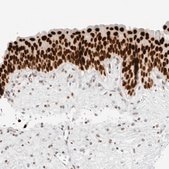 Anti-RCC1 antibody produced in rabbit Prestige Antibodies® Powered by Atlas Antibodies, affinity isolated antibody, buffered aqueous glycerol solution, ab1