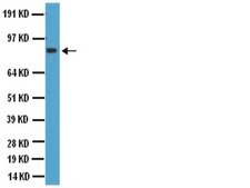 Anti-Glutamate Receptor 2 &amp; 3 Antibody Chemicon®, from rabbit
