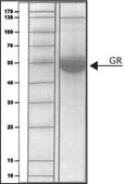 Glutathione Reductase human buffered aqueous solution, ≥10 units/mg protein, recombinant, expressed in E. coli