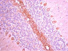 Anti-GluR1 Antibody, Recombinant, rabbit monoclonal Upstate®, from rabbit