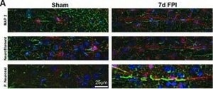 Anti-MAP2 (2a+2b) antibody, Mouse monoclonal clone AP-20, ascites fluid