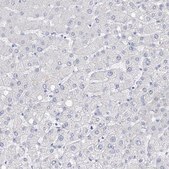 Anti-FLG antibody produced in rabbit Prestige Antibodies® Powered by Atlas Antibodies, affinity isolated antibody, buffered aqueous glycerol solution, ab3
