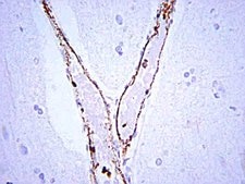 Anti-von Willebrand Factor Antibody Chemicon®, from rabbit