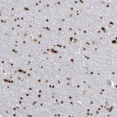 Anti-TOP2B antibody produced in rabbit Prestige Antibodies® Powered by Atlas Antibodies, affinity isolated antibody, buffered aqueous glycerol solution