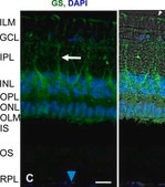 Anti-Glutamine Synthetase Antibody, clone GS-6 clone GS-6, Chemicon®, from mouse