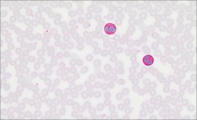 Periodic Acid-Schiff (PAS) Staining System