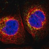 Anti-MRPL10 antibody produced in rabbit Prestige Antibodies® Powered by Atlas Antibodies, affinity isolated antibody, buffered aqueous glycerol solution