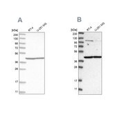 Anti-MRPL37 antibody produced in rabbit Prestige Antibodies® Powered by Atlas Antibodies, affinity isolated antibody, buffered aqueous glycerol solution