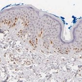 抗MKI67抗体 ウサギ宿主抗体 Ab1, Prestige Antibodies® Powered by Atlas Antibodies, affinity isolated antibody, buffered aqueous glycerol solution