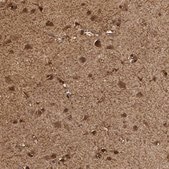 Anti-PHGDH antibody produced in rabbit Prestige Antibodies® Powered by Atlas Antibodies, affinity isolated antibody, buffered aqueous glycerol solution, Ab1