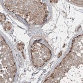 Anti-GRSF1 antibody produced in rabbit Prestige Antibodies® Powered by Atlas Antibodies, affinity isolated antibody, buffered aqueous glycerol solution