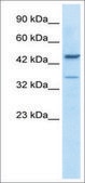 Anti-GATA3 antibody produced in rabbit affinity isolated antibody