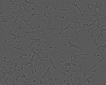 LNCap Clone FGC Cell Line human NOTE: Both the cell line and DNA from the cell line may be available for this product. Please choose -1VL or VIAL for cells, or -DNA-5UG for DNA, 89110211, human prostate (carcinoma), Epithelial-like