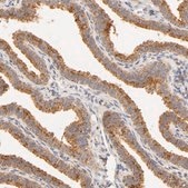 Anti-RPGR antibody produced in rabbit Prestige Antibodies® Powered by Atlas Antibodies, affinity isolated antibody, buffered aqueous glycerol solution