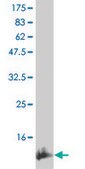 Monoclonal Anti-IL15, (C-terminal) antibody produced in mouse clone 2F6, purified immunoglobulin, buffered aqueous solution