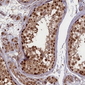 Anti-BRCA1 antibody produced in rabbit Prestige Antibodies® Powered by Atlas Antibodies, affinity isolated antibody, buffered aqueous glycerol solution