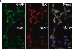 Anti-MAP2 (2a+2b) antibody, Mouse monoclonal ~2 mg/mL, clone AP-20, purified from hybridoma cell culture