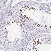 Anti-HDGFL1 antibody produced in rabbit Prestige Antibodies® Powered by Atlas Antibodies, affinity isolated antibody, buffered aqueous glycerol solution