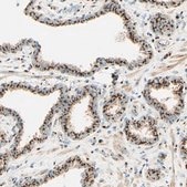 Anti-GOLGB1 antibody produced in rabbit Ab2, Prestige Antibodies® Powered by Atlas Antibodies, affinity isolated antibody, buffered aqueous glycerol solution
